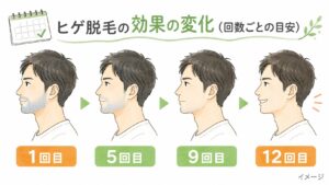 ヒゲ脱毛の効果の変化の目安。1回目から12回目にかけて青ヒゲが薄くなるイラスト(イメージ)