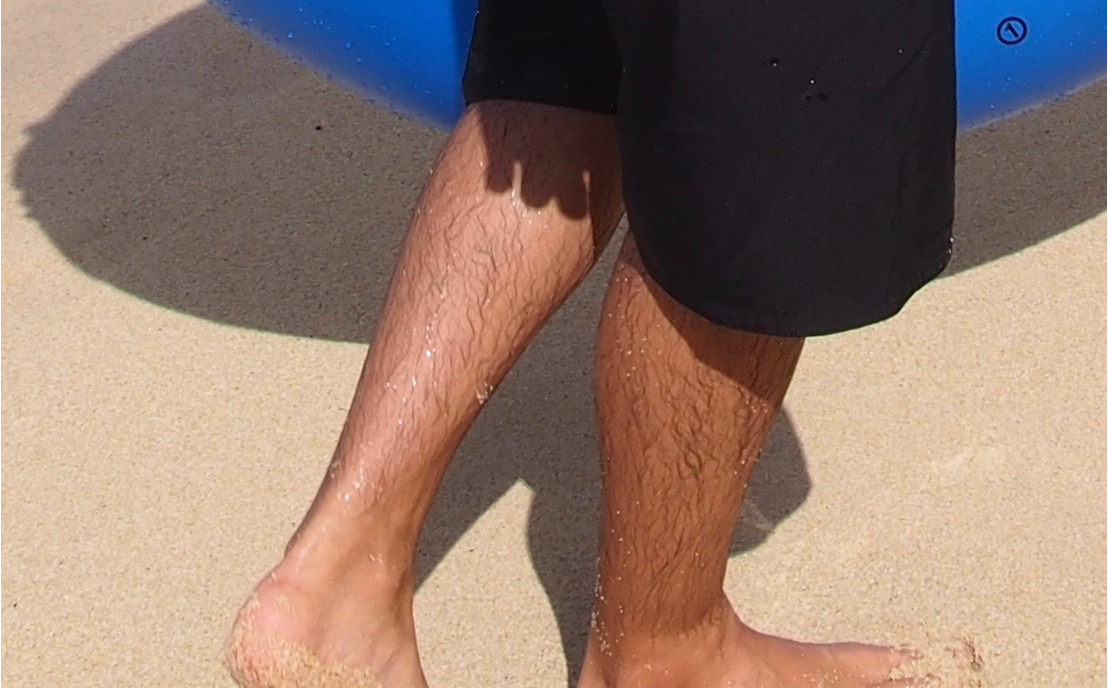 脱毛前のすね毛が濃い状態の足(海辺で撮影した筆者の実際の写真)